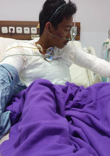 Pasang Kabel Internet, Separuh Tubuh Fathier Hangus Disetrum Listrik, DPRD Pekanbaru Desak My Republic Bertanggung Jawab