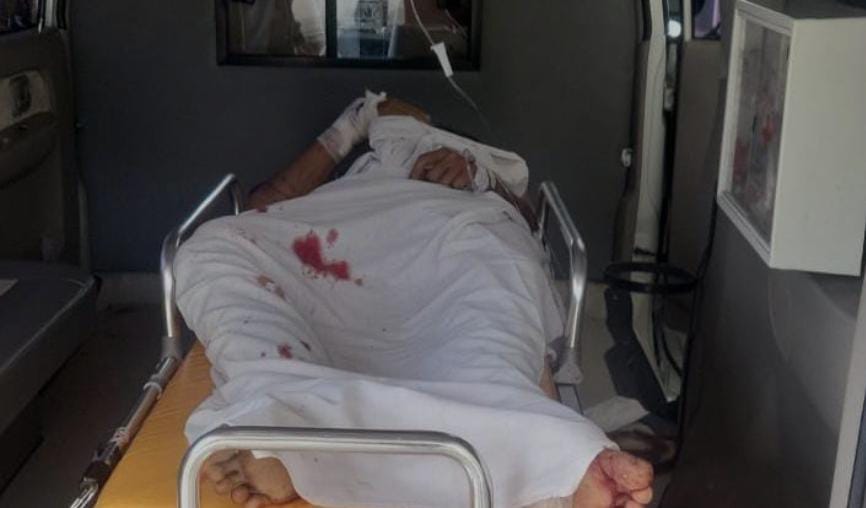 Warga Kerumutan Diserang Beruang saat Mencari Madu